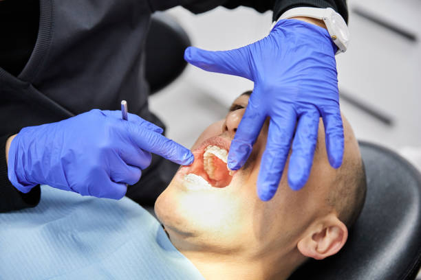Best Emergency Dental Care for Broken or Chipped Teeth in Wrightsville, PA